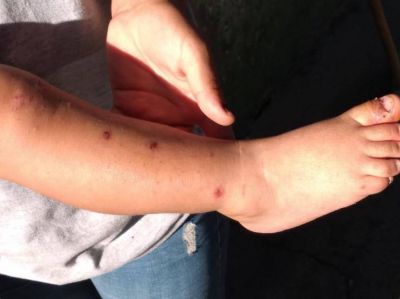 Contaminaci�n del agua: allanan campos de productores procesados en Pergamino