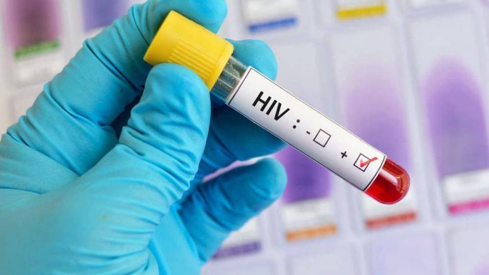 El ajuste a los pacientes de VIH lleg a los controles de transmisin