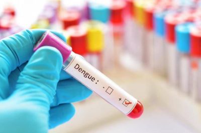 La Universidad de San Mart�n cre� un m�todo para detectar si una persona tiene dengue en 10 minutos