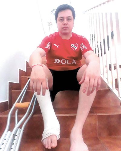 Revocaron fallo y ordenan a Osde a cubrir un sofisticado clavo intramedular