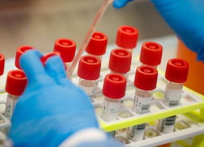 Panorama en Berisso: Fallecimiento confirmado por dengue y ning�n caso de coronavirus