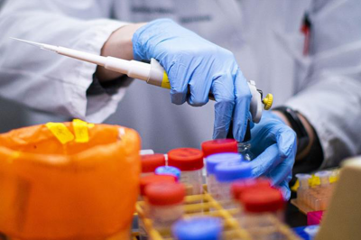 Coronavirus: la Argentina, elegida por la OMS como uno de los diez pa�ses que buscar�n la cura