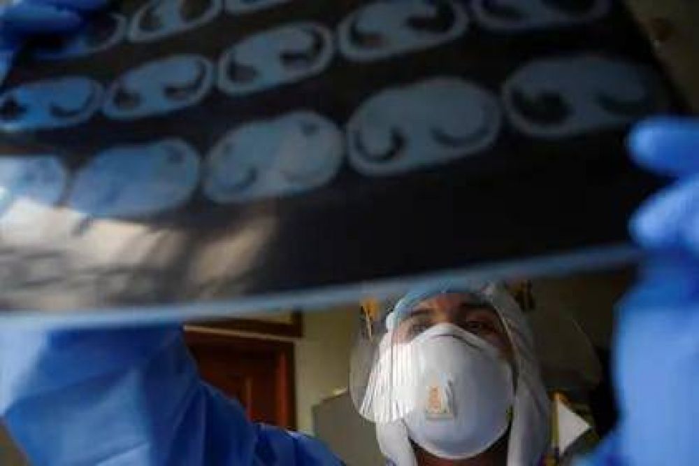 Qu� es la hipoxia silenciosa, el mal que afecta a algunos pacientes con coronavirus y que puede ser letal