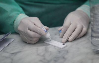 Cient�ficos argentinos desarrollaron tests r�pidos para detectar anticuerpos contra el COVID-19