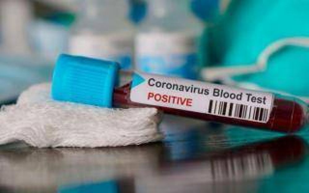 Nuevo caso de coronavirus en Berisso: 4 en total