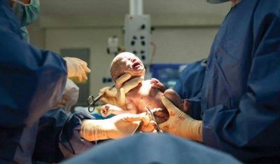 Aseguran que La Plata tiene la tasa de nacimientos por ces�rea �m�s alta de la Provincia�