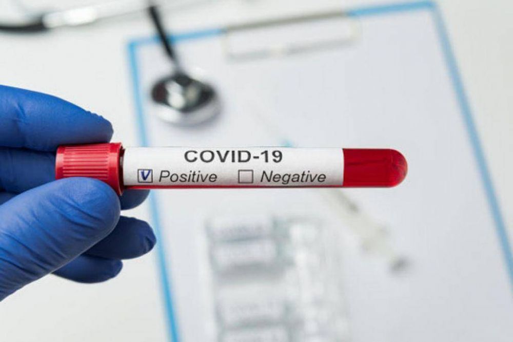 Rcord de positivos: Pergamino sum este mircoles 87 casos de Covid-19