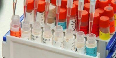 Comparar las vacunas contra el coronavirus, la tarea a cargo de la Red Mundial de Laboratorios