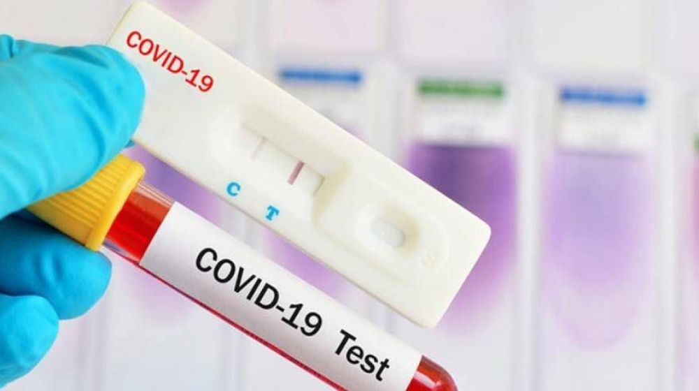 Tandil: implementan plan para ampliar la cantidad de testeos rpidos por coronavirus