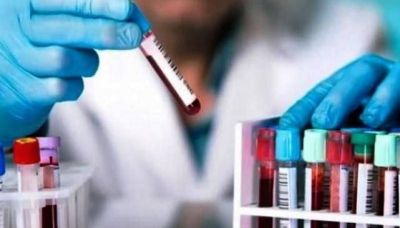 Santa Cruz registr� 96 casos positivos de Coronavirus en seis localidades