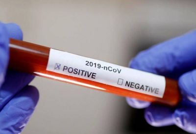 Se registraron 20 nuevos casos de covid-19 en La Rioja