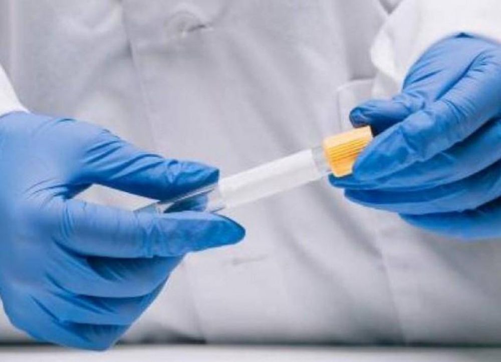 Berisso registr� 8 nuevos casos de coronavirus y son 2819 en total