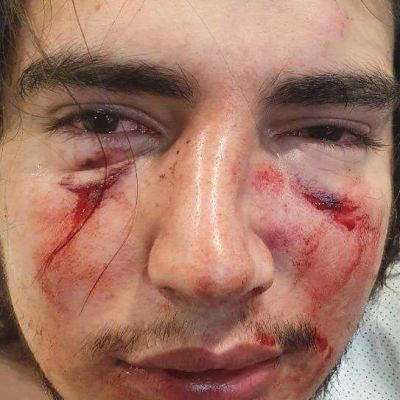 Denuncian a cuatro rugbiers por una brutal golpiza a un joven en C�rdoba