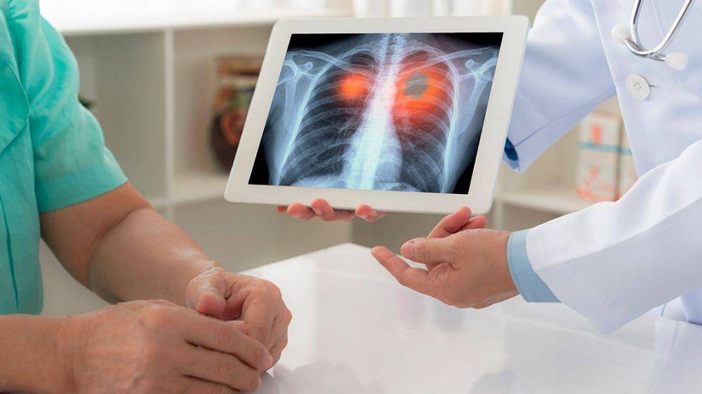 Avances de la biologa molecular para pacientes con cncer de pulmn