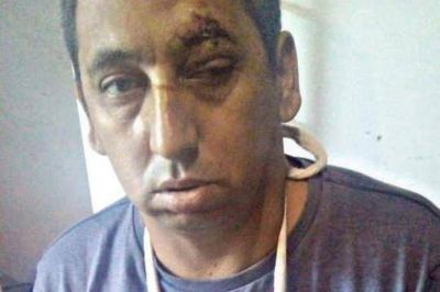 Bombas y golpes: los casos de violencia pol�tica se multiplican en territorio bonaerense