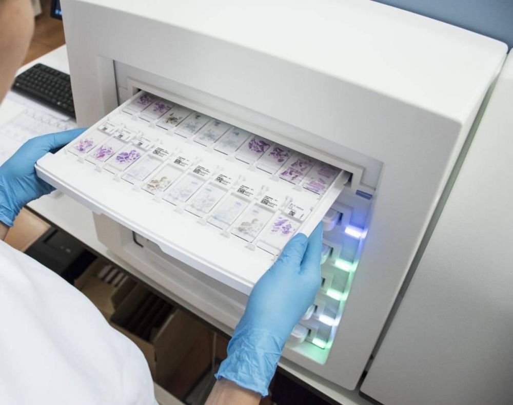 Identifican biomarcadores que podran alertar sobre el cncer a travs de un anlisis de orina