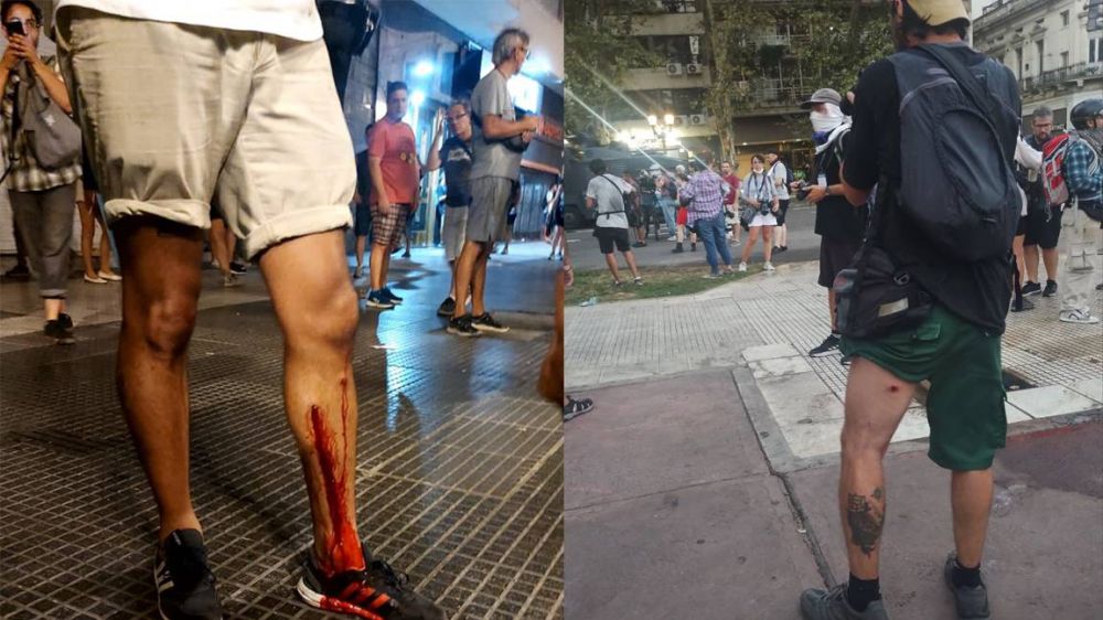 El Sindicato de Prensa de Buenos Aires repudi� la represi�n e inform� m�s de 25 trabajadores heridos mientras cubr�an la manifestaci�n en el Congreso