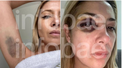 La denuncia de Fabiola Yaez contra Alberto Fernndez: Vens golpendome hace tres das seguidos