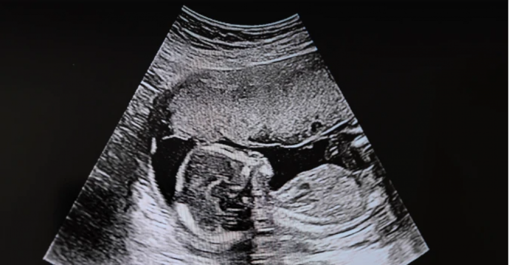 Obispos de EE.UU. aplauden ampliaci�n de la Pol�tica de Ciudad de M�xico que restringe fondos al aborto en el extranjero