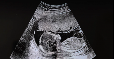 Obispos de EE.UU. aplauden ampliaci�n de la Pol�tica de Ciudad de M�xico que restringe fondos al aborto en el extranjero