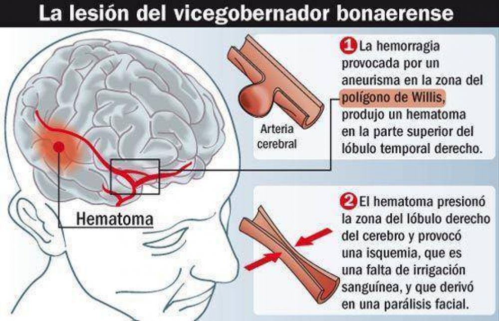 Los planes de Balestrini antes de sufrir el accidente cerebrovascular