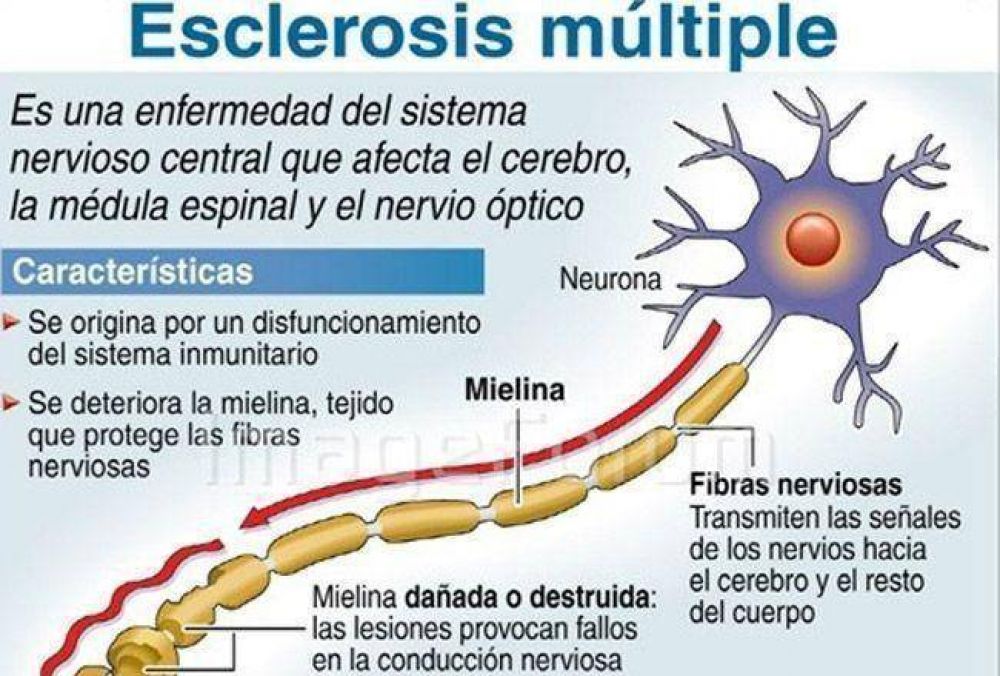Un nuevo tratamiento mejora la calidad de vida de los pacientes