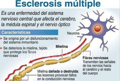 Un nuevo tratamiento mejora la calidad de vida de los pacientes