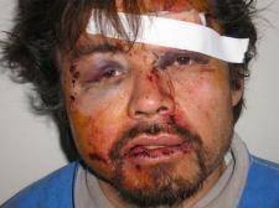 Tres j�venes propinaron brutal agresi�n a taxista