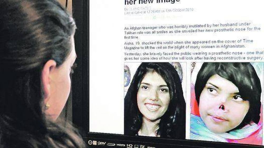  Aisha, la afgana mutilada por los talib�n, ya tiene su nueva nariz