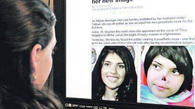  Aisha, la afgana mutilada por los talib�n, ya tiene su nueva nariz