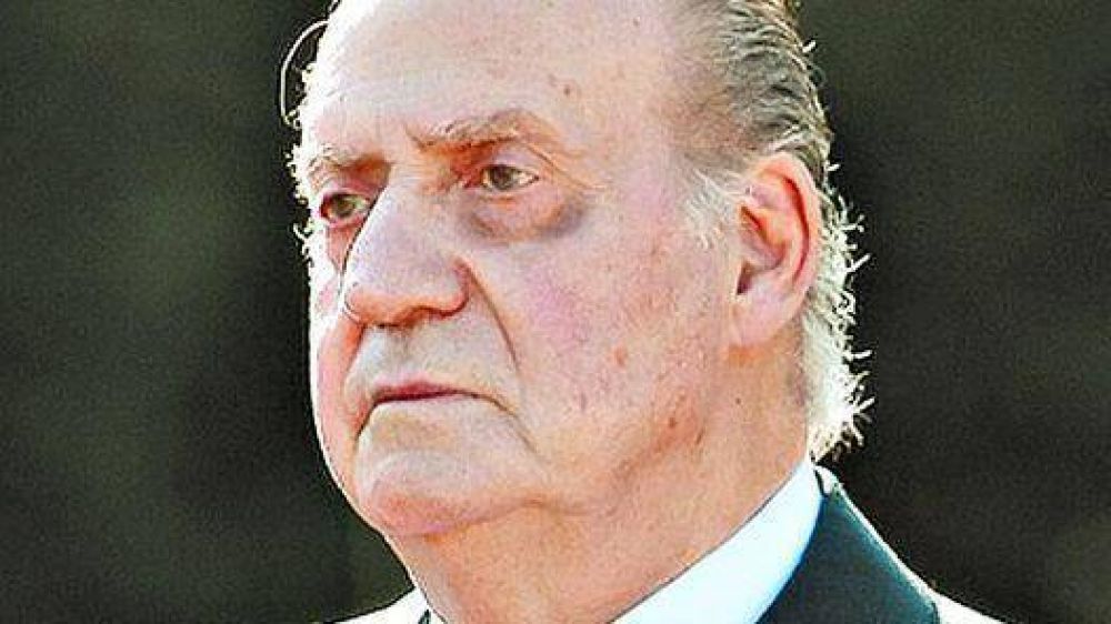 Pol�mica en Espa�a por los ojos morados del Rey
