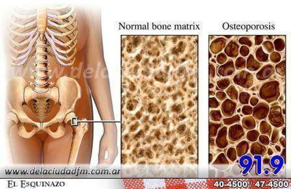 El Centro de Jubilados organiza una charla sobre osteoporosis