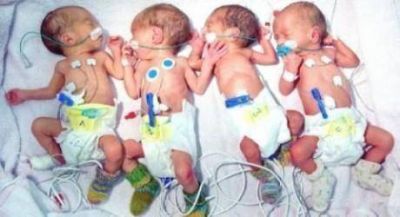 Las cuatrillizas ya se alimentan con leche de su mam�