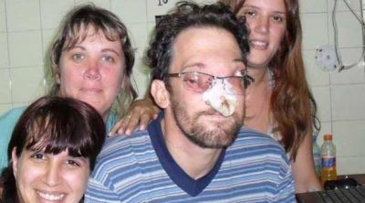 Laferrere: viajar� a Estados Unidos para tratarse un tumor de rostro