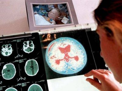 Aumentaron m�s del 35% los casos de meningitis registrados en la provincia
