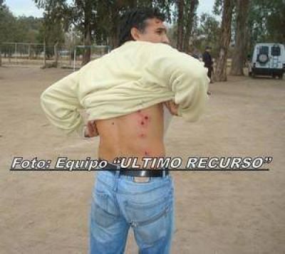  La Polic�a reprimi� con balas de goma a jugadores de Hurac�n