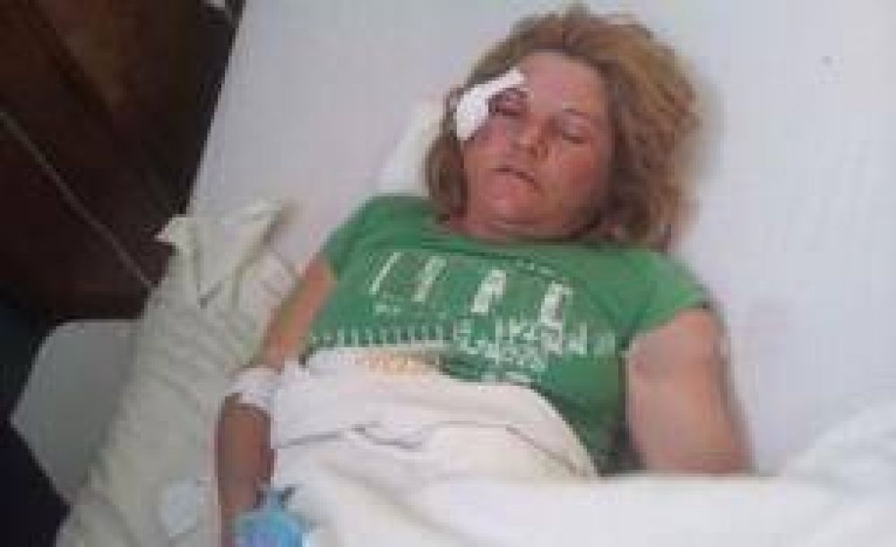 La mujer baleada por su ex apunt� contra la justicia y la polic�a