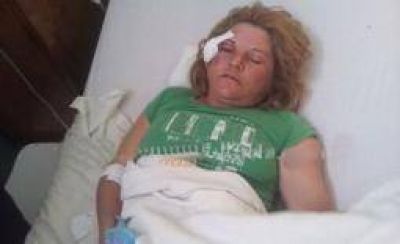 La mujer baleada por su ex apunt� contra la justicia y la polic�a