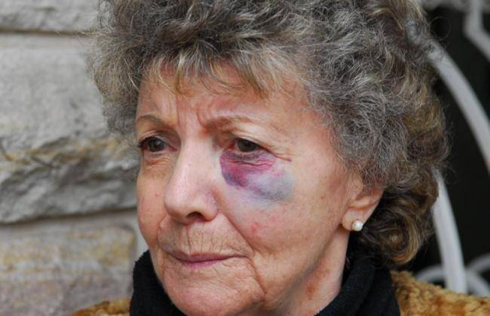 Asaltaron y golpearon a ancianos por segunda vez en dos meses