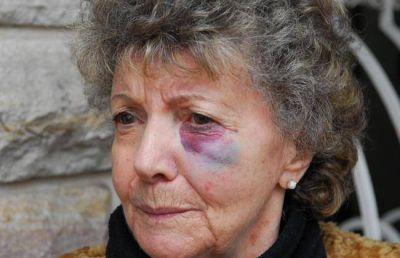 Asaltaron y golpearon a ancianos por segunda vez en dos meses