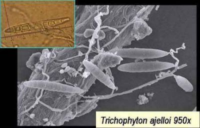 Hongos que podr�an controlar parasitosis end�micas del NEA