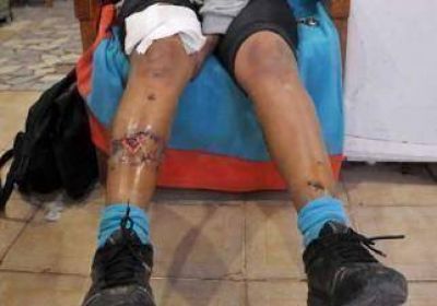 La atacaron con un dogo para asaltarla 