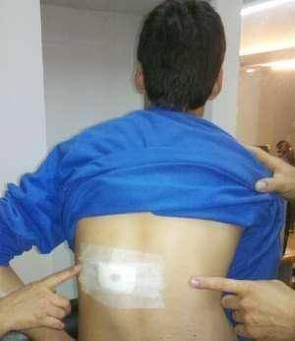 Por una regla, un alumno de 13 a�os apu�al� a otro en la calle