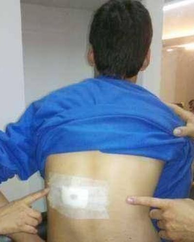 Por una regla, un alumno de 13 a�os apu�al� a otro en la calle