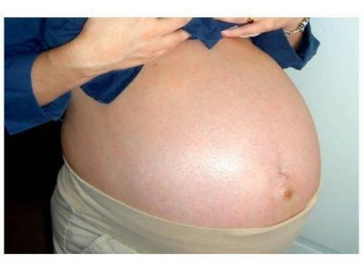 Cada vez son m�s las mujeres que postergan su maternidad
