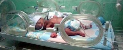 Uno de cada 2 mil ni�os puede nacer con una �enfermedad rara�