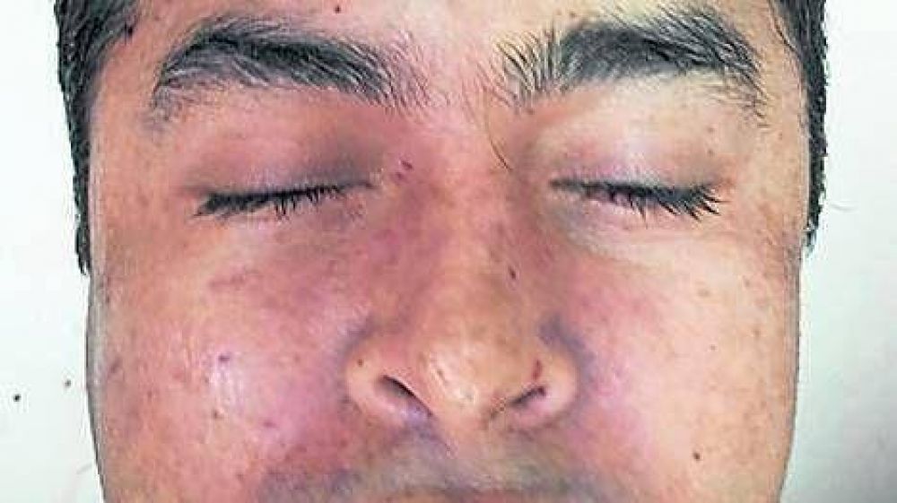 Mataron en Mxico a un jefe narco y un grupo comando rob el cadver
