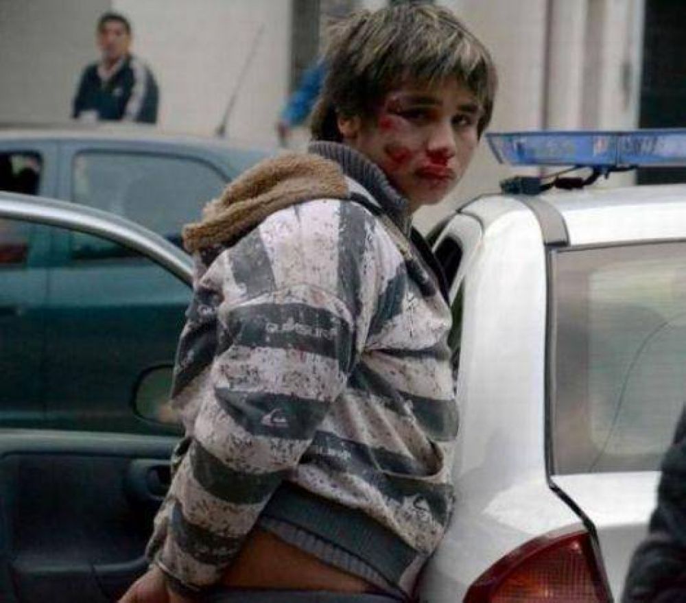 Polic�a qued� imputado por balear al motochorro