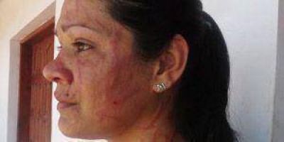 Violencia en la municipalidad de Las Lomitas