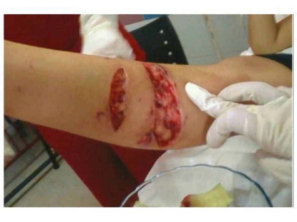 Hay alarma por un perro que mordi� a ni�os en Santa Elena